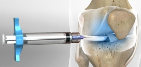 Knee Pain Management-knee pain treatment