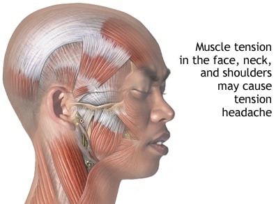 Muscle tension - Headache treatment