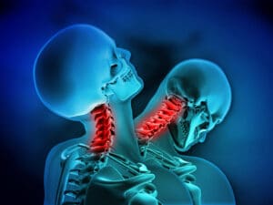 Skeletal illustration of a human after a car accident, suffers from whiplash